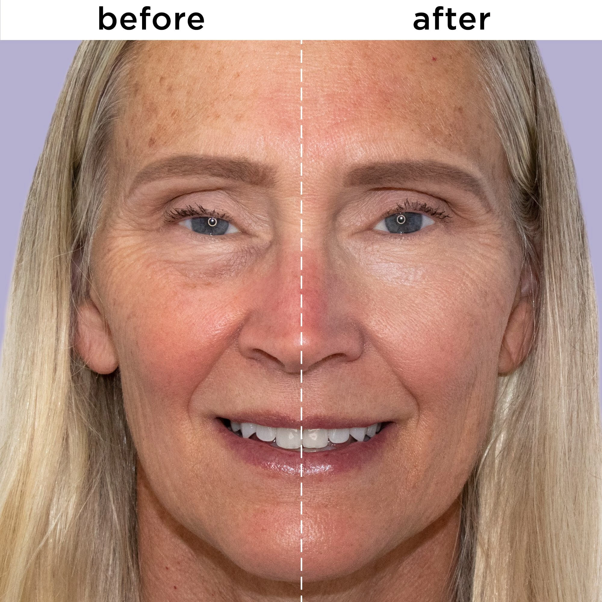 Sunshine Stick™ Illuminator 7 Sunshine Stick™ Illuminator - Image 5