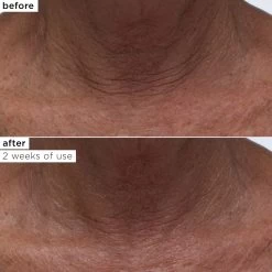 Maracuja 2% Retinol Complex Oil 15 Maracuja 2% Retinol Complex Oil -tarte sale shop 2540 maracuja 2 retinol complex oil ALT 6