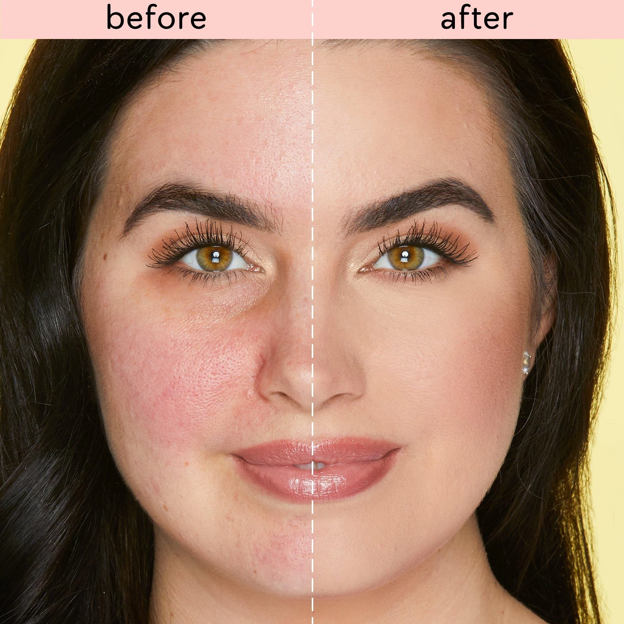 SKIN TREAT VEGAN STICK CONCEALER 5 SKIN TREAT VEGAN STICK CONCEALER - Image 3