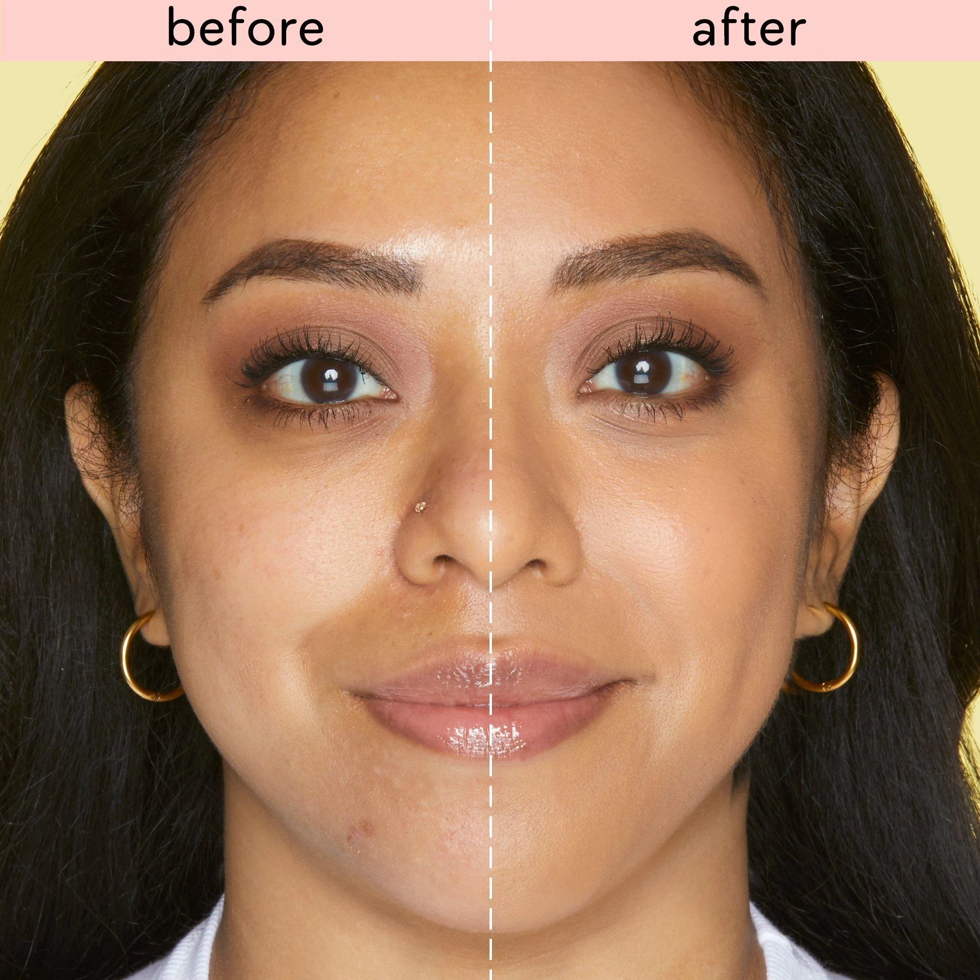 SKIN TREAT VEGAN STICK CONCEALER 7 SKIN TREAT VEGAN STICK CONCEALER - Image 5